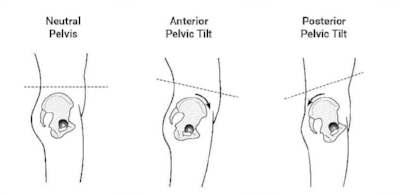 how-to-fix-anterior-pelvic-tilt